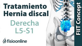 Tratamiento de la hernia discal L5 y S1 derecha o quinta lumbar y sacro [upl. by Roer]