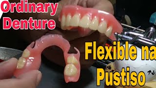 Lower Flexible Denture and Upper Partial Denture How you like That Denture in the Philippines [upl. by Rowney118]