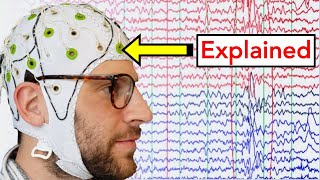 EEG Electroencephalogram Explained [upl. by Aiuqram]