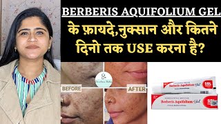 Berberis Aquifolium Gel Benefits amp Side effects ॥ कितने दिन में Results मिलते है [upl. by Binnings]