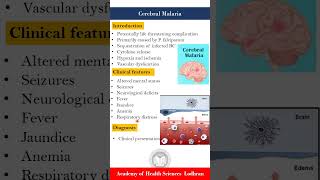 Cerebral malaria by Imran Yaseen [upl. by Adyahs]