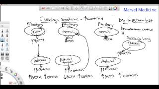 Cushings syndrome and the Dexamethasone suppression test [upl. by Chrystel]