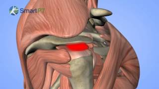 Shoulder Impingement [upl. by Julietta620]