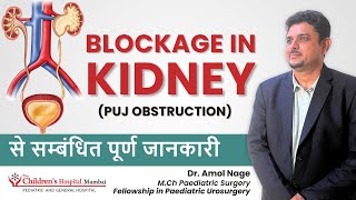 PUJ Obstruction in Infants  Pyeloplasty surgery for Kidney by Dr Amol Nage [upl. by Sinegra]