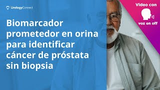 Biomarcadores en orina podrían identificar el cáncer de próstata antes de la biopsia [upl. by Brentt]