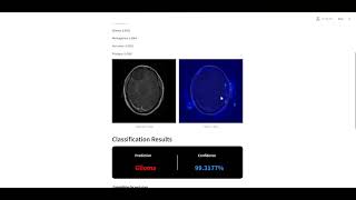 Brain tumor Machine learning Classification project with Streamlit UI [upl. by Berard]