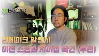 3Shape 서실장s DAILY TALK  리메이크 발생시 이전 스캔과 차이점 확인 루틴 [upl. by Evan]