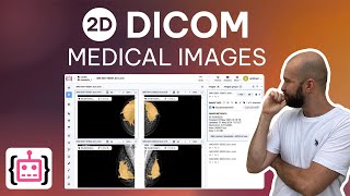 2D Medical Images in Supervisely How to Annotate DICOM Mammograms [upl. by Assirod745]