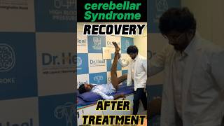 Stroke Recovery After treatment ad viral video fyp [upl. by Weslee183]