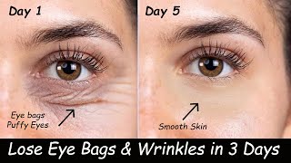 Remove Under Eyebags amp Eye Wrinkles in 3 Days  Vaseline for Dark Circles Carrot Gel amp Eye Exercise [upl. by Nohtan]