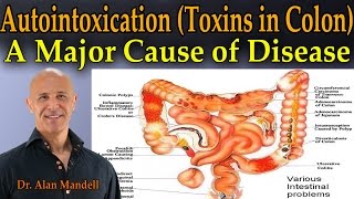 Autointoxication Toxins in the Colon  A Major Cause of Pain Sickness and Disease  Dr Mandell [upl. by Hardunn]