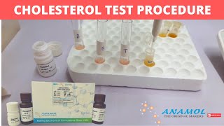 CHOLESTEROL Test Procedure  CHOLESTEROL Reagent  Procedure for performing CHOLESTEROL Reagent Test [upl. by Ailec947]