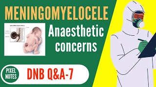 ANAESTHETIC Concerns of MENINGOMYELOCELE [upl. by Vigor]