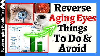 REVERSE AGING EYES – Things To DO amp AVOID [upl. by Viridis694]