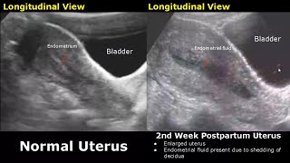 Gynecological amp Obstetric Ultrasound Normal Vs Abnormal Scan  Uterus Ovary Cervix Pregnancy USG [upl. by Relyt]