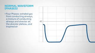 Principles of CapnographyLesson 3 Capnography waveforms [upl. by Fionna]