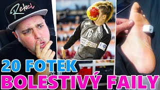 20 FOTEK OPRAVDU NEJBOLESTIVĚJŠÍCH FAILŮ [upl. by Ayocal]