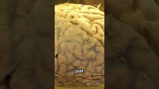 Mind blowing brain storage fact education braintest mindset discovery [upl. by Edobalo]