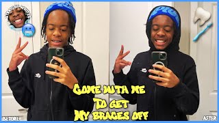 I’M NERVOUS 😬  COME WITH ME TO GET MY BRACES OFF  MINI VLOG [upl. by Aicen]