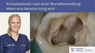 Komplikationen nach einer Wurzelbehandlung Wenn eine Revision nötig wird [upl. by Skipp]