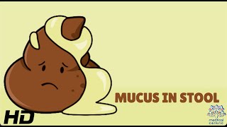 Mucus In Stool Everything You Need To Know [upl. by Anurag660]