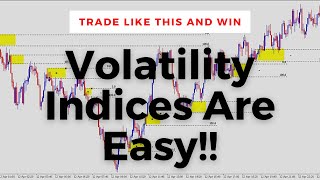 How To Trade Volatility Indices Institutional Trading Strategies [upl. by Naoj]