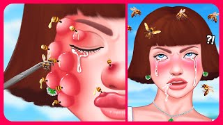 Treatment amp removal of the BEE STINGER stuck in the cute girls face 🐝 Satisfying ASMR Animation [upl. by Eiznekcam]