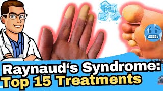 Raynauds Syndrome vs Phenomenon vs Disease Why Are My Toes Cold [upl. by Kendry]