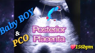 Genderreveal with Baby Movements Why amp When  Posterior Placenta with baby💙  PCO  Polycystic ovary [upl. by Aidnama]