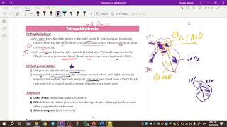 Pediatrics cardiology  tricuspid atresia amp ebstein anomaly amp truncus arteriosus [upl. by Afatsum]