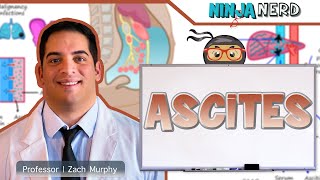 Ascites  Clinical Medicine [upl. by Assirod]