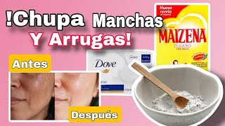 ✅️ Como eliminar MANCHAS en la cara por el sol CON ESTA MASCARILLA CASERA [upl. by Reese]