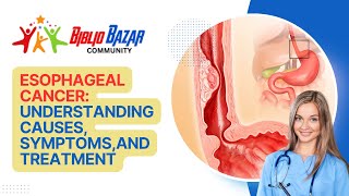 🩺 Understanding Esophageal Cancer Symptoms Treatment and Care 🩺 [upl. by Ilrebma28]