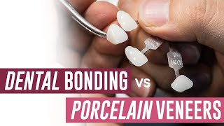 Dental Bonding vs Porcelain Veneers  Which Should I Get [upl. by Anoif534]