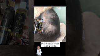 audora hair oil review in Tamil hairfalltreatment haircare [upl. by Rapp]