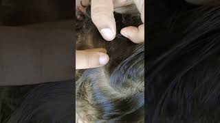 ASMR LICE lice hairstyle liceremoval hairlice hair nomorelice [upl. by Moira]