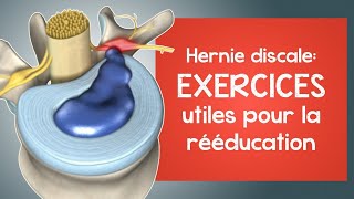 Hernie discale  des exercices utiles pour la rééducation [upl. by Siderf]