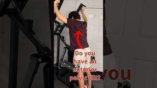 Try these exercises to help reverse anterior pelvic tilt [upl. by Ecnarf]