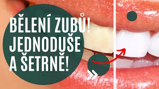 💡Jediné bělení zubů které Vám ponechá dlouhodobě bílý úsměv a nezničí zuby ✨ [upl. by Cerelia]