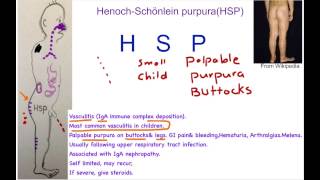 HenochSchönlein Purpura Mnemonic [upl. by Emmey769]