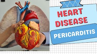 Pericarditis Disorders Types Symptoms Causes and Treatments Explained [upl. by Akiemat]