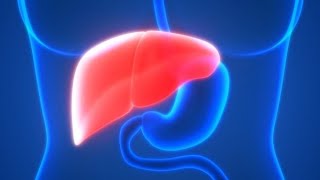 Diagnosis of Hepatocellular Carcinoma [upl. by Ikkaj924]