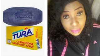 TURA SOAP TO GET RID ANCE AND DARKSPOT ALLANTOIN A Must Watch Honest Review [upl. by Eidda841]