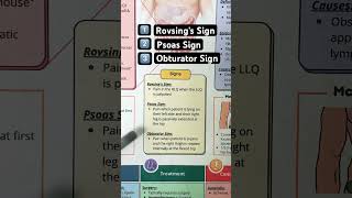 🔥 3 Signs of Appendicitis in 60 SECONDS Psoas Obturator Rovsing [upl. by Mat]