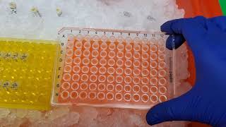 Running qPCR of cDNA [upl. by Rinum467]