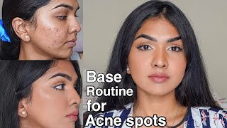 Flawless base routine for acne prone skin  acne pigmentation [upl. by Zsa]