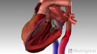 3D Medical Animation  Congestive Heart Failure [upl. by Darrick]