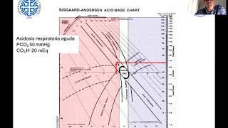 Acidosis y Alcalosis [upl. by Enyallij604]