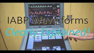 IABP Waveforms [upl. by Wolenik818]