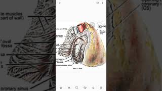 Right Atrium Sulcus Terminalis crista Terminalis  coronory sulcus [upl. by Ybocaj]